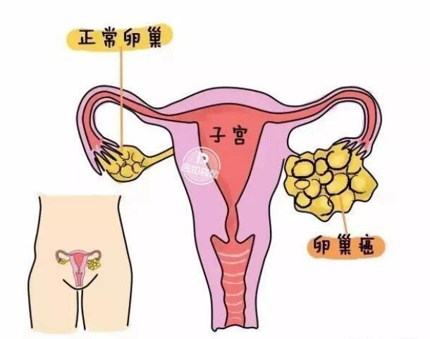 卵巢是女性非常重要的生殖器官,卵泡就是生长在卵巢内的,卵泡发育