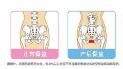 产后恢复的这些指标，你都达标了吗？