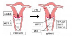 产后子宫多久后才能恢复正常