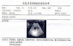 怀孕B超单图片你真的会看吗？怀孕B超全解析