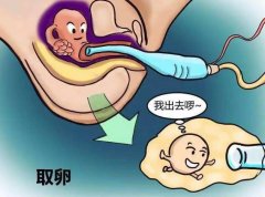 试管取卵后要卧床休息多久？腹水多久会消失