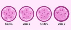 试管婴儿如何选择优质胚胎？原来是胚胎有等级制度